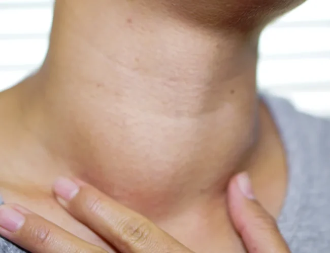 के तपाईलाई पनि यस्तो समस्या छ ? होशियार