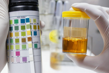 पिसाबको रंगबाट थाहा पाउनुहोस आफ्नो स्वास्थ्य समस्या